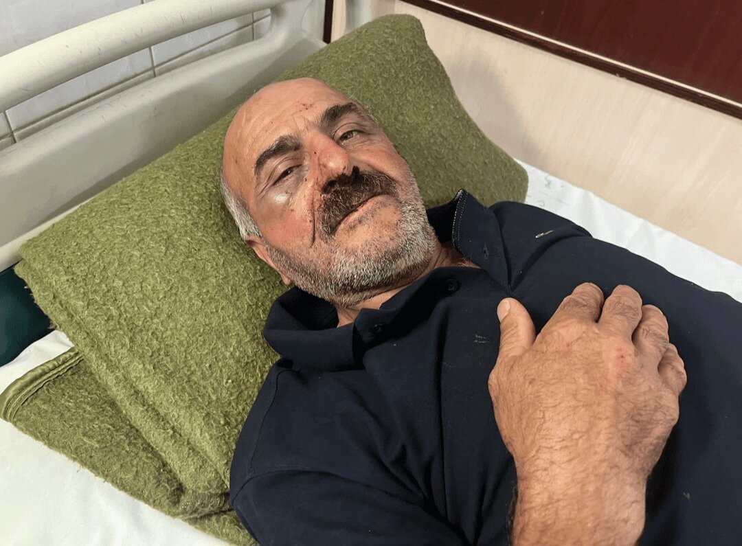 حمله خونین قاچاقچی چوب به جنگلبان چالوسی در روز ملی جنگلبان