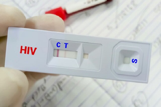 کاهش نقش اعتیاد در انتقال HIV؛ تغییر الگوی شیوع بیماری در ایران